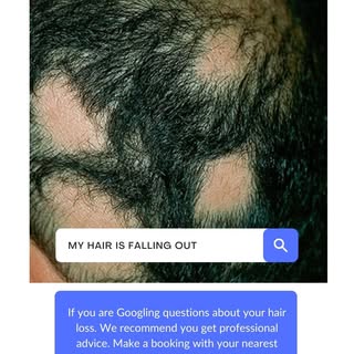 TrichoSynergy Hair loss clinic in London specialises in hair and scalp treatments for men and women 
