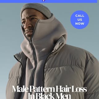 Hair loss is a common concern for many men, but Black males often face unique challenges when it com