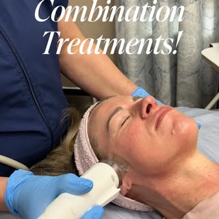 Microneedling with RF and NouvaDerm are the ultimate duo when it comes to skin resurfacing, tighteni