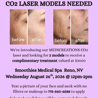 We are looking for 2 people to be models for our MEDICREATIONS CO2 Laser. This is a complimentary tr