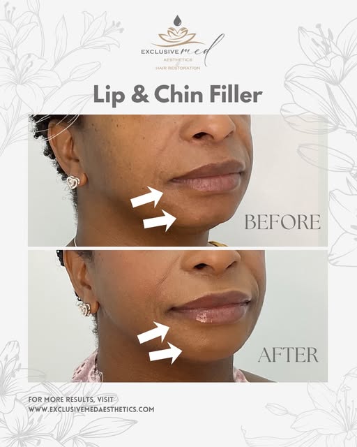 A little balance can make a BIG difference. 💋

These beautiful before & afters by our NP Selina sho