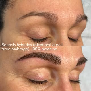 Redéfinir son regard et regagner la paix d’esprit ça n’a pas de prix. Bon ok, des nouveaux sourcils 