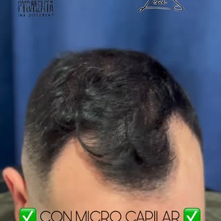 ¡1ª SESIÓN - ANTES Y DESPUÉS! ✅

🎈NUESTRA CLÍNICA:
📍Barcelona📍
Calle Rosselló 218 - L’Eixample 🌉
