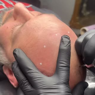 PRIMERA SESIÓN COMPLETA - MICRO CAPILAR EFECTO RAPADO 🤩

¿Quieres realizarte un tratamiento de Micr