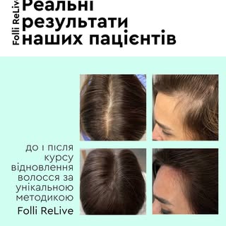 Жодних фільтрів — лише чесні «до» і «після» ✨
Переважно всі результати, які ти бачиш, досягнуті завд