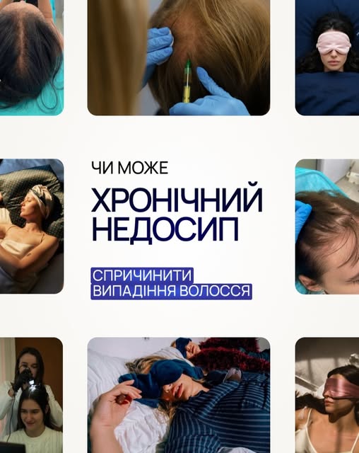 Сам по собі один безсонний тиждень — навряд чи. Але регулярний сон по чотири-п’ять годин може стати 
