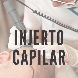 ¿Has notado pérdida de cabello? 🤔 Estamos aquí para ayudarte 😉

👨🏻‍⚕️Dr. José Iván Vázquez Aguil