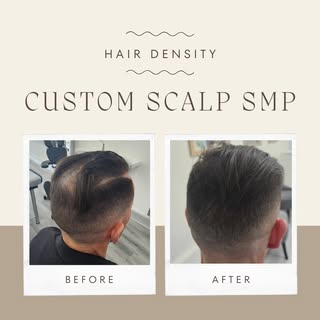 Struggling with thinning hair?

Scalp Micropigmentation fills in sparse areas to create the look of 