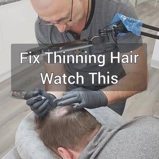 Scalp Micropigmentation Melbourne – The Fix for Men’s Hair Loss 👨‍🦲

Hair loss in men? Here's the 