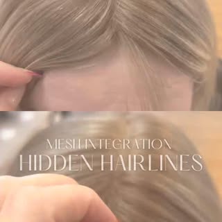 Our Hidden Hairline Mini online course is the perfect solution for achieving discreet and comfortabl