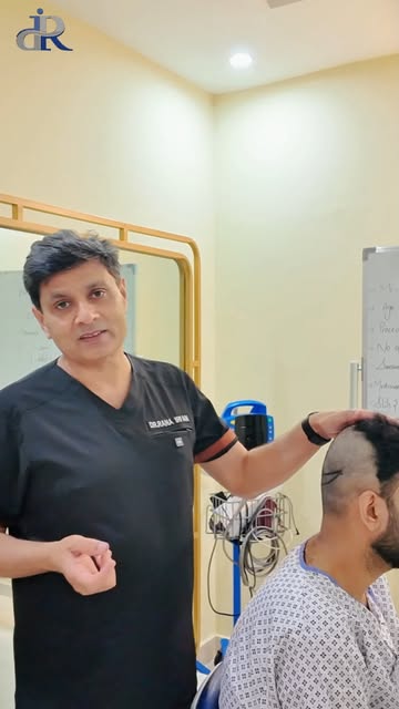 Why precise donor math is the real secret to a permanent hair transplant.
It’s not just about moving