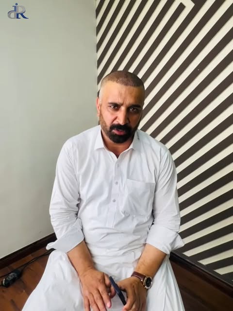 post-operative review after undergoing a hair transplant procedure with Dr. Rana Irfan.
From initial