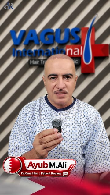 After searching for 2 whole years across the globe, I finally found the perfect hair transplant spec