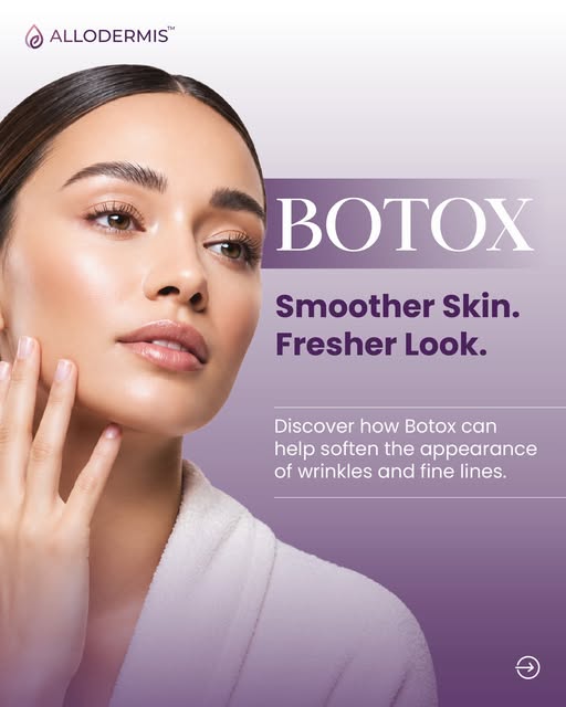 Botox: A smoother, fresher-looking you ✨💉

Fine lines and wrinkles are a natural part of aging, but