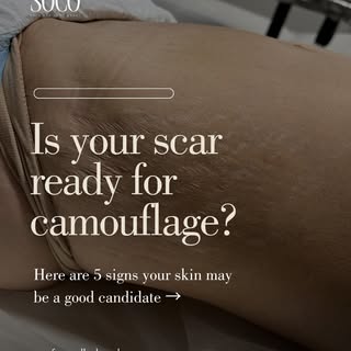 Not every scar is ready for camouflage — and that’s something responsible paramedical artists will a