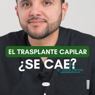 ¿El cabello trasplantado se cae? Entendiendo el proceso de crecimiento👇🏻

Hablamos sobre el proces