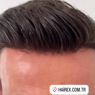 Tutkuyla yapılan iş, başarıyı da beraberinde getirir. 👊🎉 @hairexbodrum @hairexcomtr @hairex.samsun