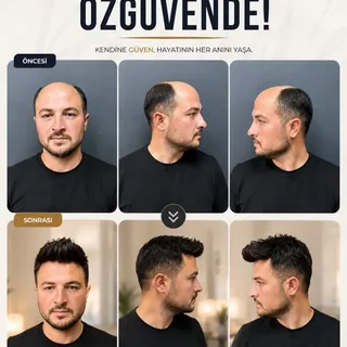 DOĞAL PROTEZ SAÇ UYGULAMASI

Detaylı bilgi için : 0(533) 738 28 76

@hairex.samsun @hairexankara @ha