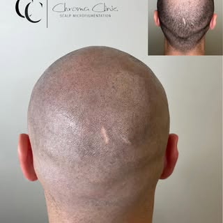 My name is Jordan, and I’ve been addicted to killing bald crowns for 4 years now.