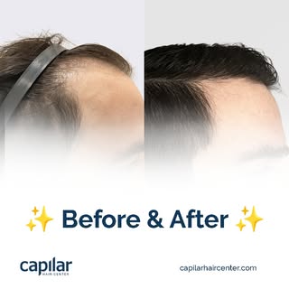 The transformation you’ve been looking for.

Book your appointment now:
📞 USA: (619) 213-0244
📞 ME