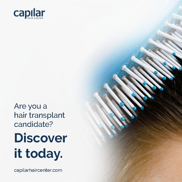 Worried about hair loss? At Capilar Hair Center, we help you solve it with an expert diagnosis. 🩺✨
