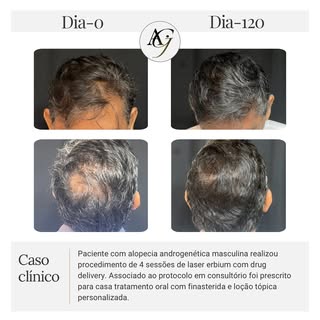 Você sabia que duas pessoas com
o mesmo diagnóstico podem ter respostas completamente diferentes ao 