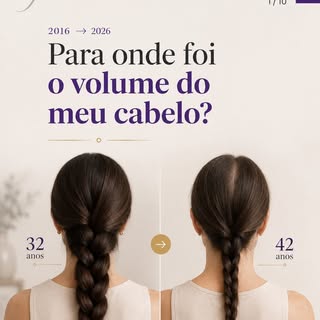 👩‍⚕️ O eflúvio telógeno crônico acontece quando uma proporção maior de fios entra repetidamente na 