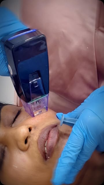 Key Benefits:

* Helps tighten and firm loose or sagging skin
* Stimulates collagen and elastin prod