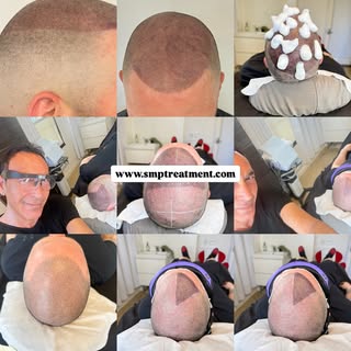 🔥 Another Life-Changing SMP Transformation 🔥

Confidence starts with the right artist.

Every scal
