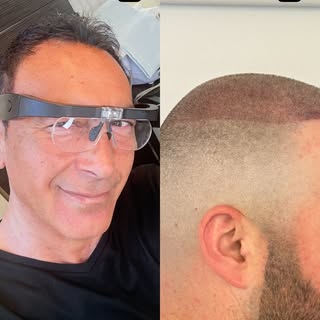 🔥 Another Life-Changing SMP Transformation 🔥

Confidence starts with the right artist.

Every scal