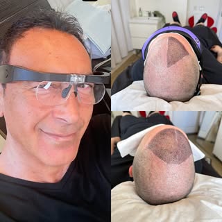 🔥 Another Life-Changing SMP Transformation 🔥

Confidence starts with the right artist.

Every scal
