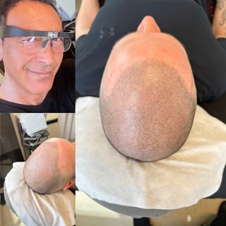 🔥 Another Life-Changing SMP Transformation 🔥

Confidence starts with the right artist.

Every scal