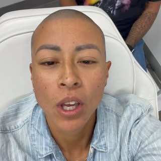 Alopecia colab with @picassojeff /// Finished up a final session and it’s looking amazing. If you st