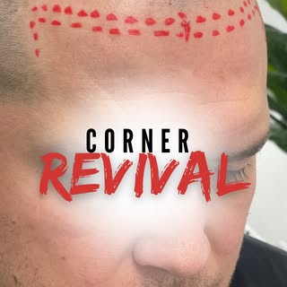 Lower, natural corners make all the difference. 🌋

Bringing in the hairline edges creates a stronge