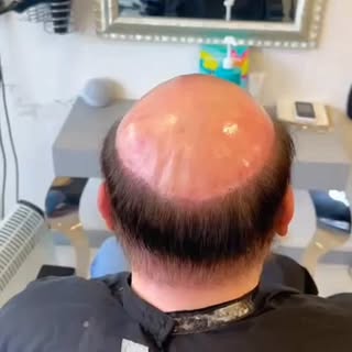 HAIR FITTING ✨

#hairreplacementcardiff #hairreplacementsystem #hairreplacement #hairlosscardiff #no