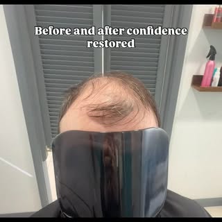 First fitting at Crown Hair such an amazing transformation restored confidence and feeling like fabu