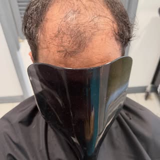 Amazing  transformation before and after