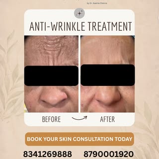If wrinkles make you avoid close-up photos…
If your face looks tired even when you feel fine…

It’s 