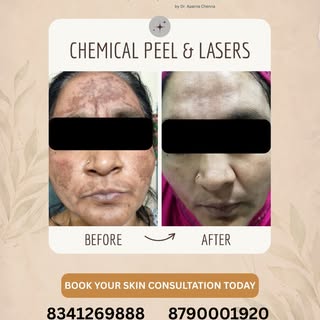 Pigmentation can be caused by:
• Sun damage
• Hormonal changes
• Aging
• Inflammation

That’s why tr