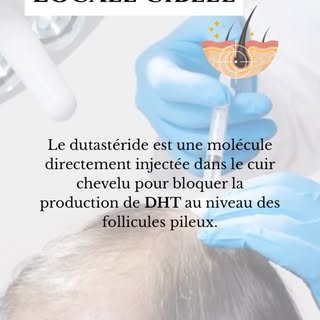 𝐋𝐄 𝐃𝐔𝐓𝐀𝐒𝐓𝐄𝐑𝐈𝐃𝐄 𝐄𝐍 𝐌É𝐒𝐎𝐓𝐇É𝐑𝐀𝐏𝐈𝐄 

Pour la perte et l’affinement du cheveux, 