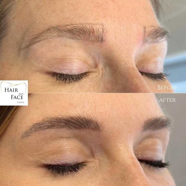 𝐌𝐈𝐂𝐑𝐎𝐁𝐋𝐀𝐃𝐈𝐍𝐆

Résultat d’un très joli microblading réalisé par 𝗠𝗺𝗲 𝗝𝗲𝘀𝘀𝘆 𝗩𝗮𝗻 