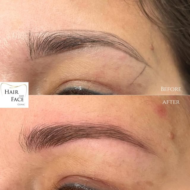 𝐌𝐈𝐂𝐑𝐎𝐁𝐋𝐀𝐃𝐈𝐍𝐆

Résultat d’un microblading très naturel réalisé par 𝗠𝗺𝗲 𝗝𝗲𝘀𝘀𝘆 𝗩𝗮