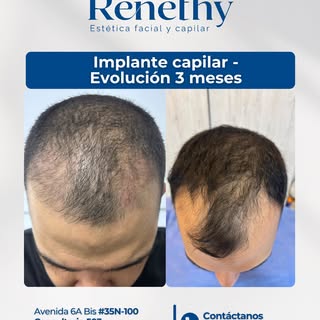 3 meses pueden marcar el inicio de un gran cambio. 💙

Cada paciente vive un proceso diferente, pero