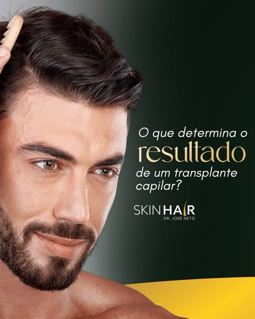 O que realmente influencia o resultado de um transplante capilar? 🧔🏻‍♂️

Não é apenas a técnica. O
