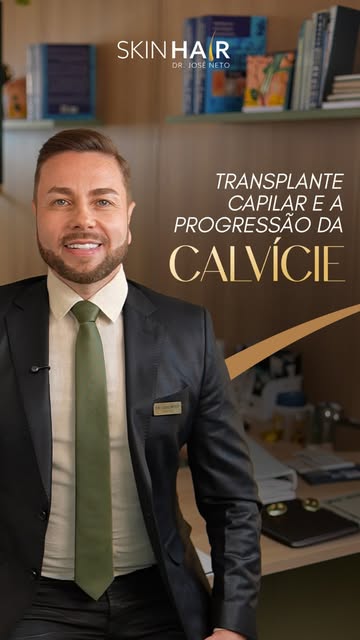 ⚠️ O transplante capilar pode recuperar áreas que já perderam densidade, mas não significa que a cal