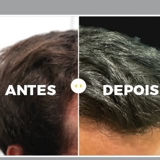 Na CapilarPro efetuamos um planeamento individualizado, tendo em conta as necessidades e expectativa