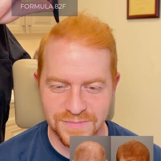 Stop hair loss and promote regrowth with advanced topical treatment.

Formula 82F combines four powe