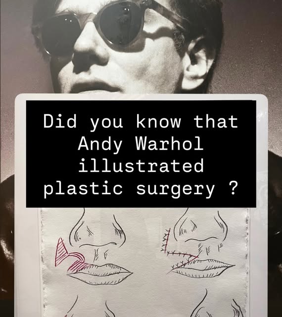 Longtime before plastic surgery became an Instagram thing :)