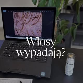 ❌ Włosy wypadają?
❌ Skóra głowy swędzi?
❌ Czujesz, że coś jest nie tak?

To właśnie przy tym biurku 
