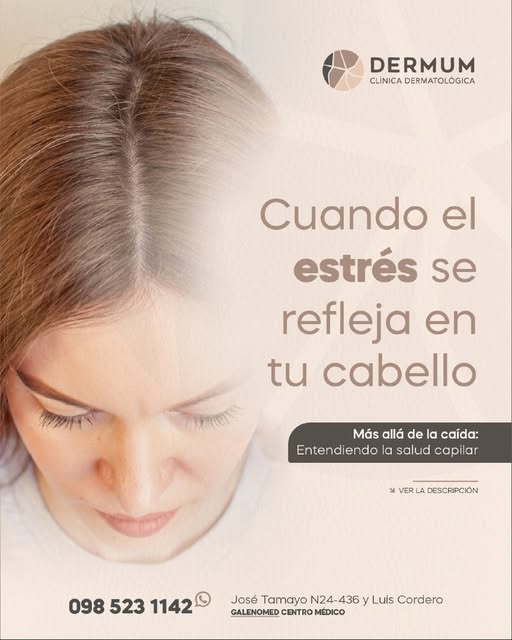 Más allá de la caída: Entendiendo la salud capilar. La pérdida repentina de cabello en zonas localiz